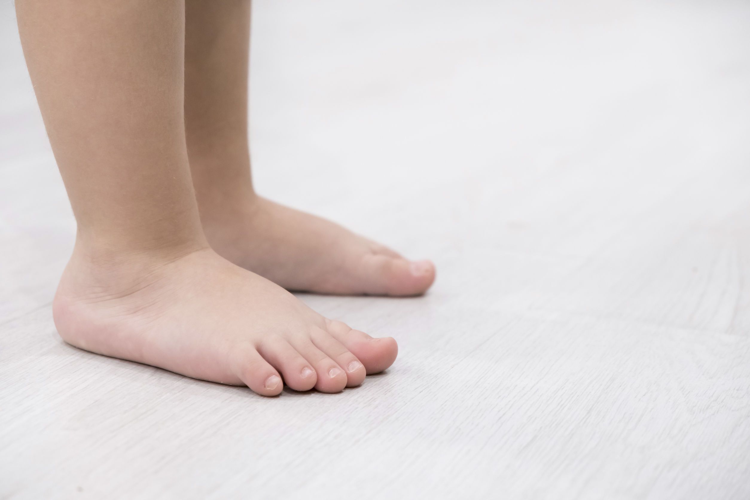 voetklachten Soepele platvoet bij kinderen